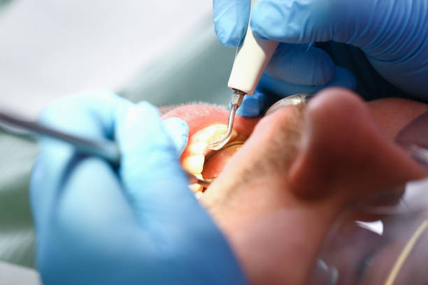 Best Emergency Tooth Extraction in Seaville, NJ